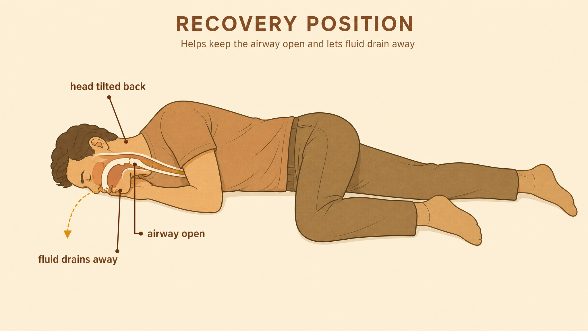 Labeled illustration showing the recovery position: person on their side, head tilted back, airway open, fluid draining away from the mouth
