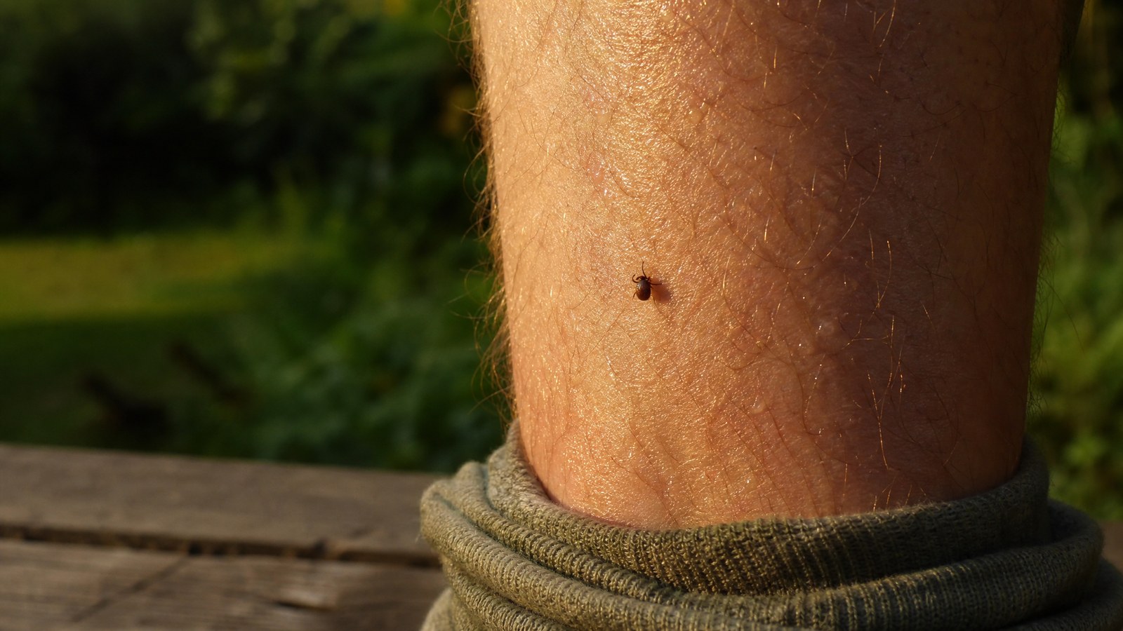 Close-up of a small dark tick attached to the skin of an adult's lower leg, found during a tick check in warm evening light